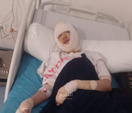 ✅ جدل متواصل حول حادث البارك بطنجة : مستخدم يقدم روايته والعائلة تكشف حقيقيتها