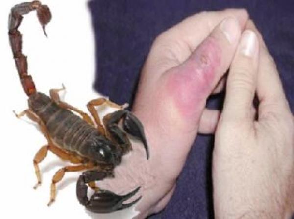 لسعات العقارب ولدغات الأفاعي..من المسؤول عن غياب الأمصال في مراكز جهة مراكش؟ – Kech24: Morocco News – كِشـ24 : جريدة إلكترونية مغربية
